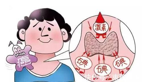 甲状腺癌|35岁女士为怀二胎竟查出癌症医生称这类孕妇越来越多