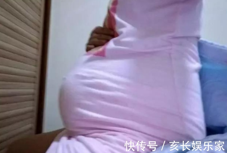 医生|怀孕7个月后胎儿停止心跳,医生取出胎儿时称 是孩子救了亲娘