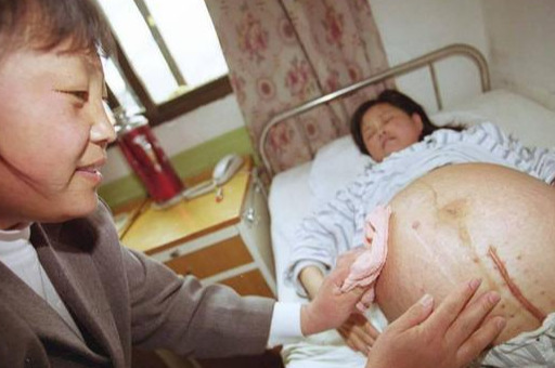 宫缩|孕晚期肚子又硬又紧，是不是胎儿要提前“退房”有4种可能情况