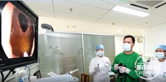 牙刷|20厘米长17岁少年刷牙时吞掉它，医生20多年来第一次见