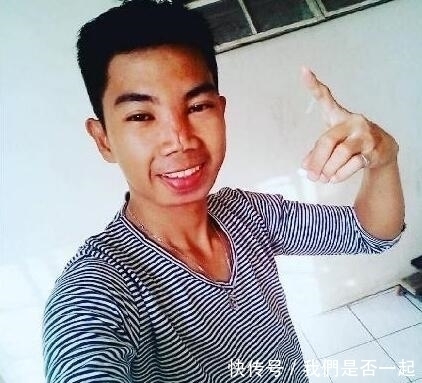 小伙花费70元整容，结果整容失败致脸部溃烂，帅小伙变成“丑男”