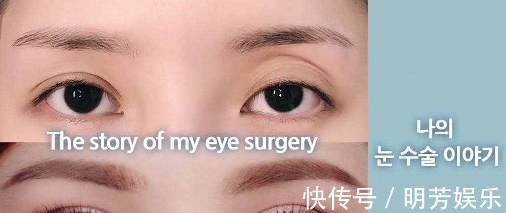 Pony 美妆教主Pony大方坦承整形两次!术后跟粉丝分享“术前VS术后”!