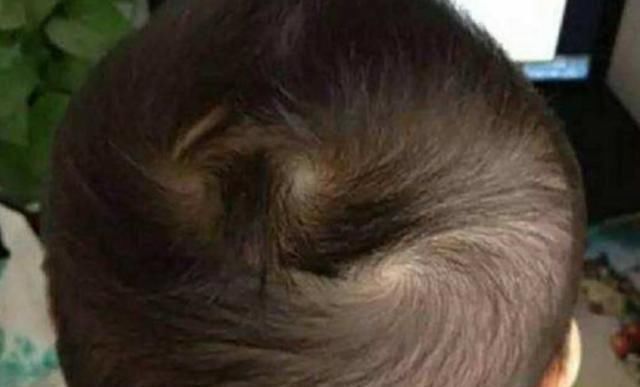 孩子|头上有“2个旋”的宝宝,是性格更好还是命更好?家长别分不清