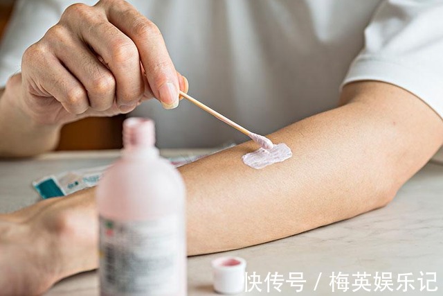 黑色素|44岁女士,坚持吃维生素E以淡化脸上斑点,结果怎样,不妨借鉴