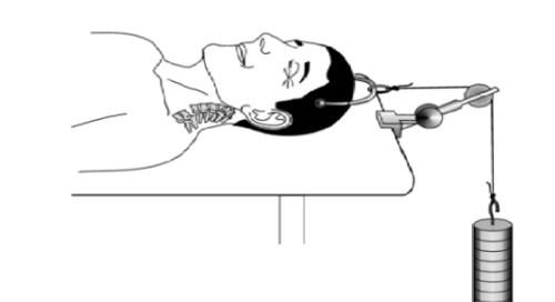 头晕头痛|头晕头痛？脖子酸痛？手麻？颈椎病这个“流行”病要注意