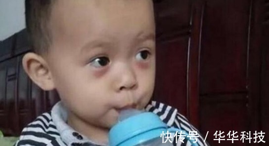 积食|5岁男童长期积食不在意,拖成“疳积”,医生:家长太无知了