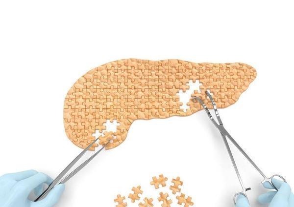 黄疸|胰腺癌常“伪装”成胃病，身体频繁出现4项异常，注意检查