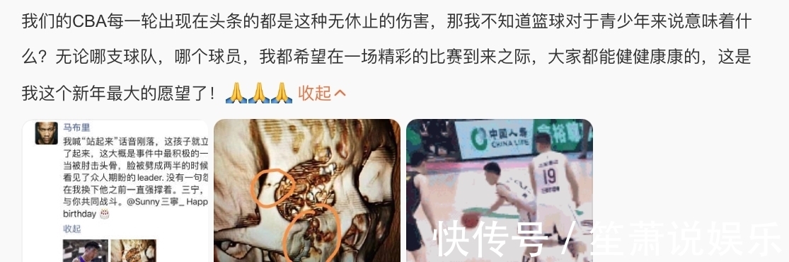 篮板|篮坛新增伤号,北控超级新秀骨折,脸被劈开,马布里痛失爱徒