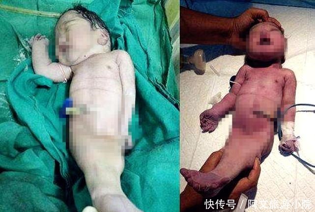 看清楚|产妇生下孩子,看清楚孩子模样后惊呆众人,孕期不忌口惹的祸