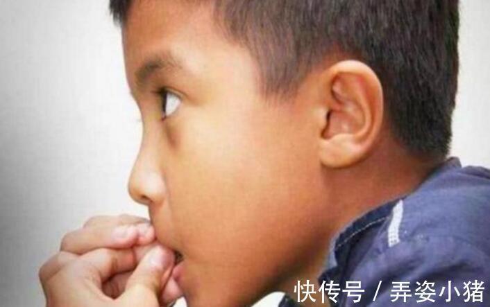 宝妈|小时候喜欢“啃指甲”的孩子,长大后会怎样无法避开这几种结局