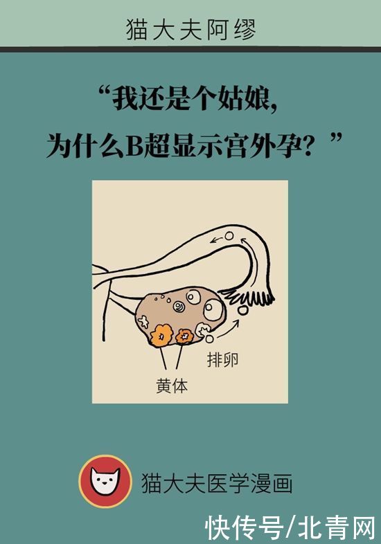 腹痛|这种腹痛常被误认宫外孕，背后诱因要牢记