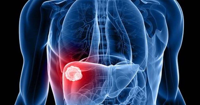 食物|肝不好的女人，3种食物是肝脏的“救星”，远离肝癌、肝硬化