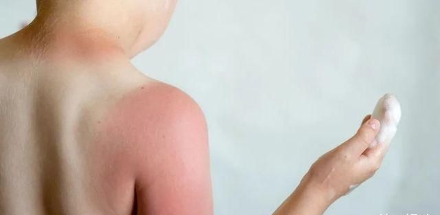 儿童防晒重点，你知道了吗？