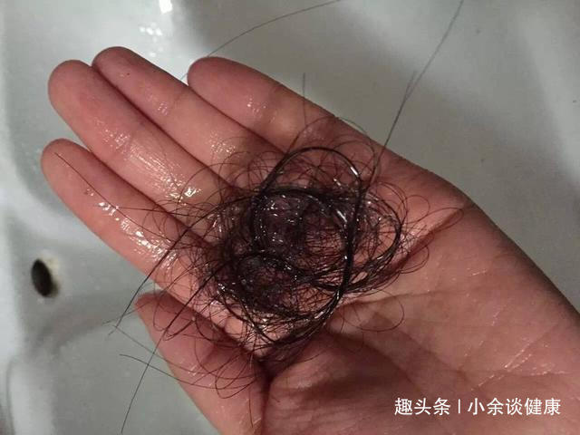 营养素|失眠是缺镁，脱发是缺锌，身体缺乏“营养素”的6种表现，你有吗