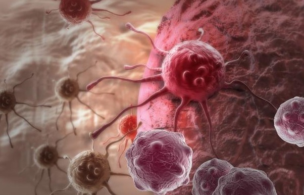 肿瘤|肺癌早期不疼不痒,身体2处持续瘙痒,说明肺受损,是时候养肺了