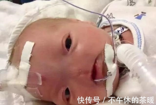 一生|小男孩天生无鼻,却坚持走完了一生