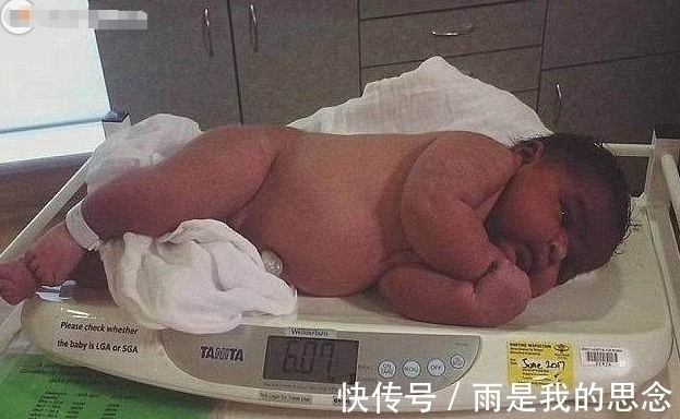 剖腹|孕妈妈剖腹产下宝宝，在场医生都吓一跳，6个月后宝宝是这样！