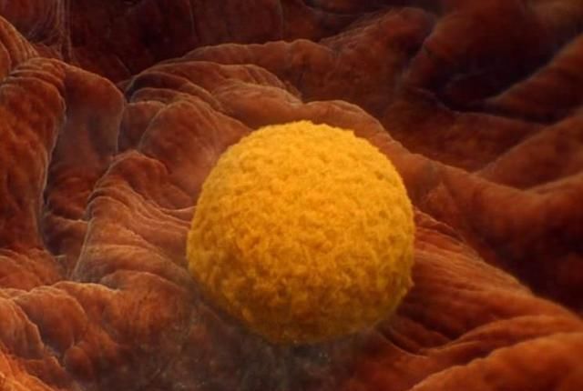 地震|胎停育就像一次生活“大地震”，这7个原因，不得不留意！