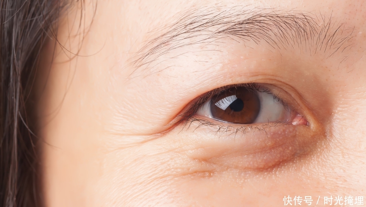 小周|出现4个症状，说明你的血脂已经很高了！抓紧时间调理，别忽视