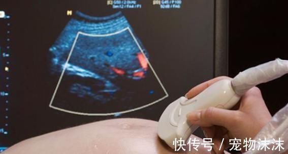 检查|产检时,为什么医生总是很重视孕28周?这真的是道坎吗?