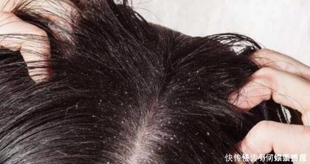 洗头|女生“洗头”常犯这3个错误,怪不得头发“越洗越油”,难怪异性缘为0