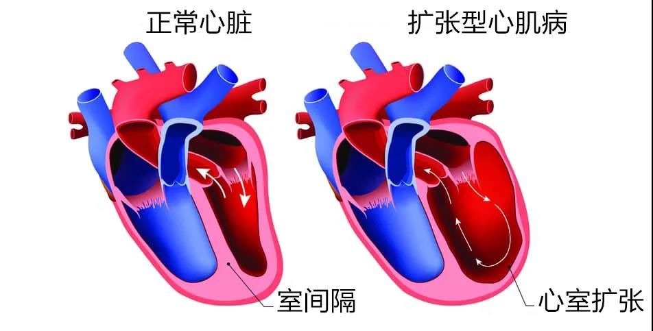 心肌细胞|【健哥说心脏】球王之死