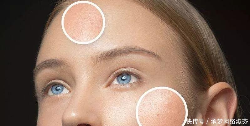 激素脸|为什么很多女生不护肤反而皮肤更好?坚持做这3件事,皮肤都不差