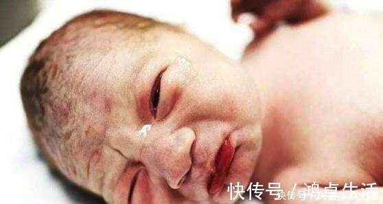 视力|宝宝出生时,有的睁开眼,有的闭上眼,哪种比较好医生说都好