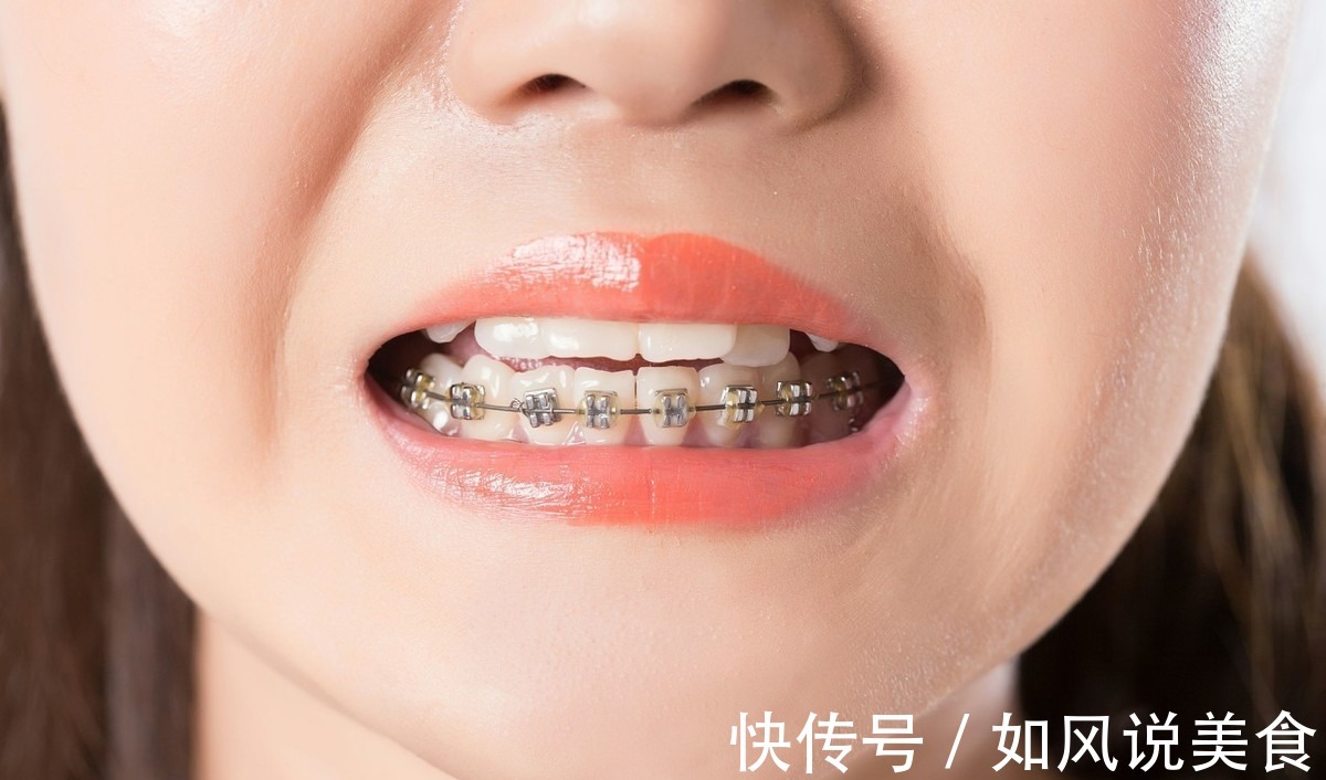 正畸|儿童做牙齿矫正三个最佳时间家长要牢记,矫治越早干预效果越好