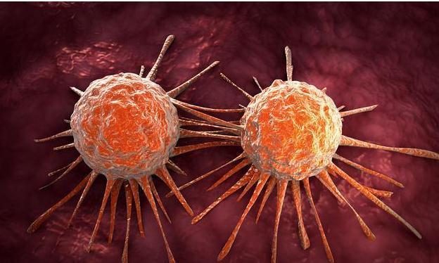 癌细胞|癌症为什么至今攻克不了，而且非常难治？肿瘤医生揭晓3个原因