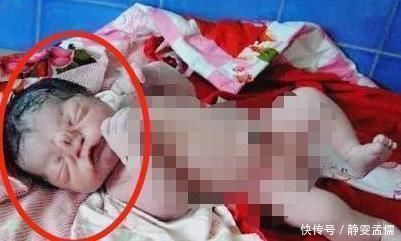 b超|50岁产妇生下“猪八戒”宝宝,遭全家嫌弃,医生一番话救了孩子