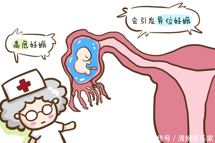 红十字会|孕妈若是有这四个特征,说明可能是“高危”孕妇,可别不当回事儿