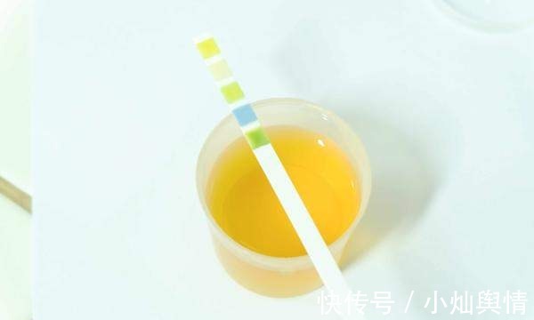 症状表现|乙肝癌变前，身体4个部位早知道，别不当回事