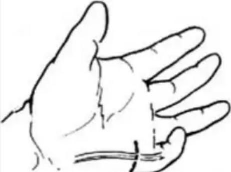 畸形|孩子长得“太漂亮”像洋娃娃,医生:这是一种病!