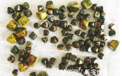 胆囊|胆结石吃什么可以化掉?本文为你揭开不动手术治疗胆结石的真相