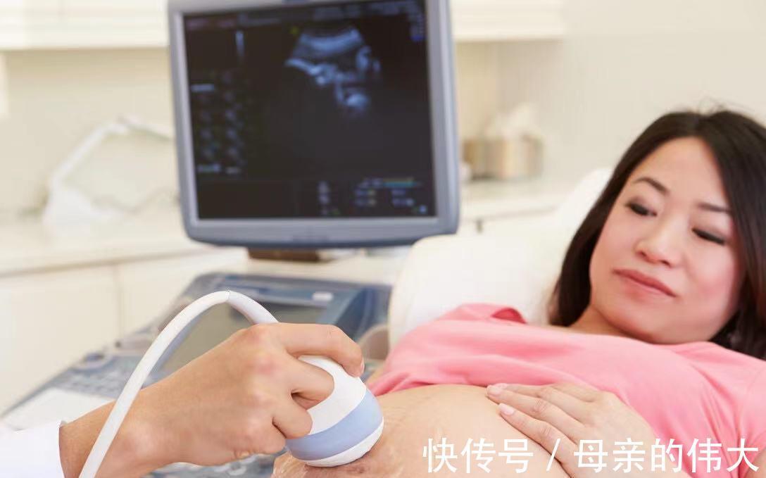 孕期|孕期四维彩超,准妈妈第一次见到宝宝的样子,那些准备你做好没