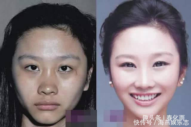 实拍：10张女孩整容前后的对比照，这真就是换了一张脸