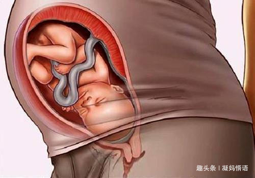 宝宝|孕妈感觉胎儿踢肚子一般有3种情况,第三个说明宝宝在“求救”