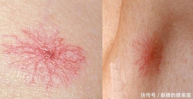 失调|内分泌失调根本原因,身上这个器官在捣乱,养肝就是养命