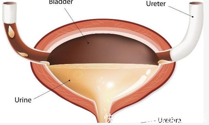 起夜|晚上起夜与不起夜,哪个更健康?泌尿科医生现在为你解答!