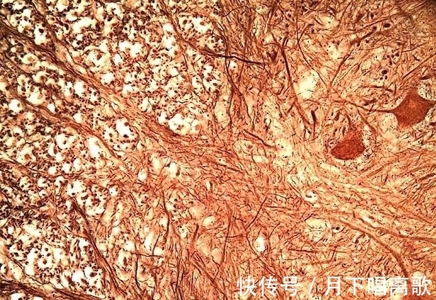 奇趣|精选一组奇趣图片;世界上最长的头发、显微镜下的睫毛及舌头