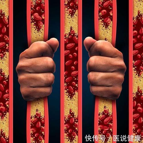 维生素e|动脉硬化到来时,多吃这4种食物,或能恢复血管弹性,不妨试试