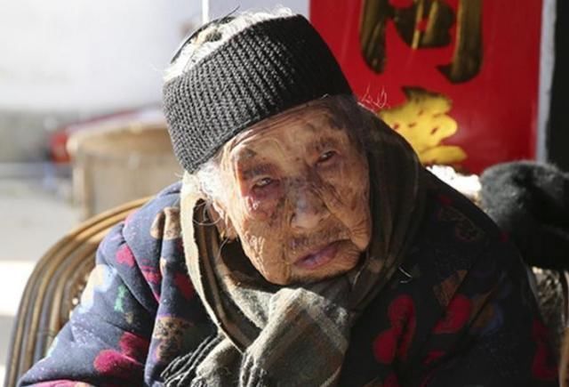 令人吃惊|95岁老人脸上无老年斑,精神状态比30岁时还好,养生方令人吃惊