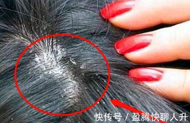 icu|女儿被妈妈用农药焗头驱虱进ICU，女人的无知比“农药”更可怕