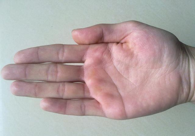 燕麦|你清楚“糖尿病”吗？如何降“血糖”？建议：常吃以下这5种食物