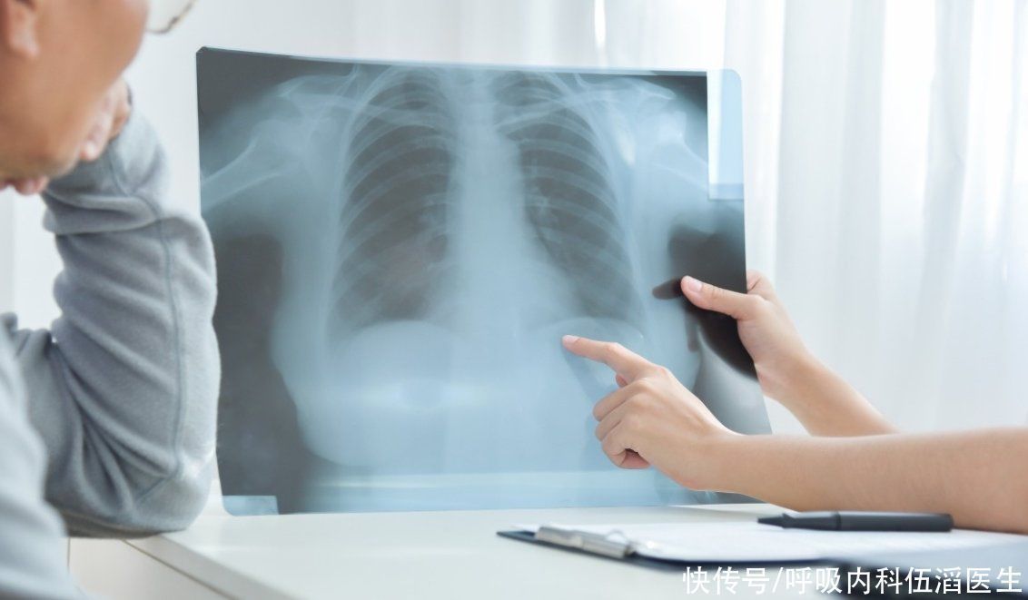 阴影|女教师体检发现阴影,迷糊不细究,4年后医生痛责,已发展成肺癌