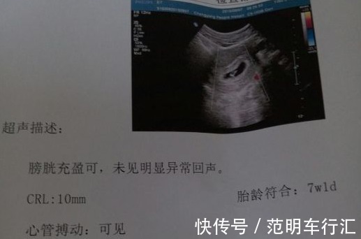小秘密|孕检单上的“小秘密”,孕检单上出现这种结果时,恭喜您已知答案