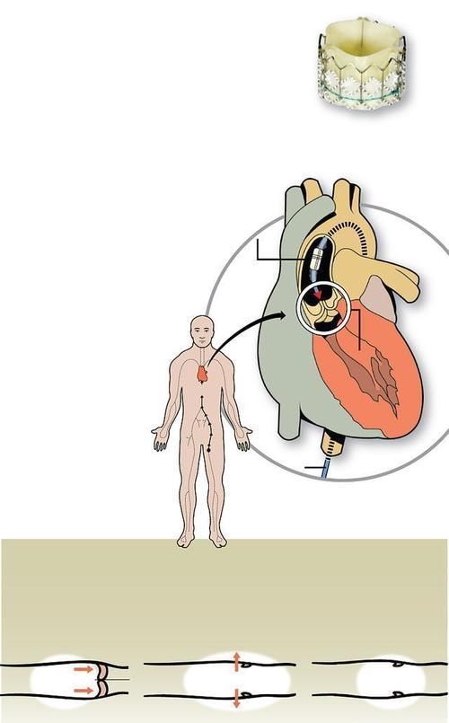 先天性心脏病|心脏彩超能检查出什么病来?心血管医生:这几种心脏病都可以