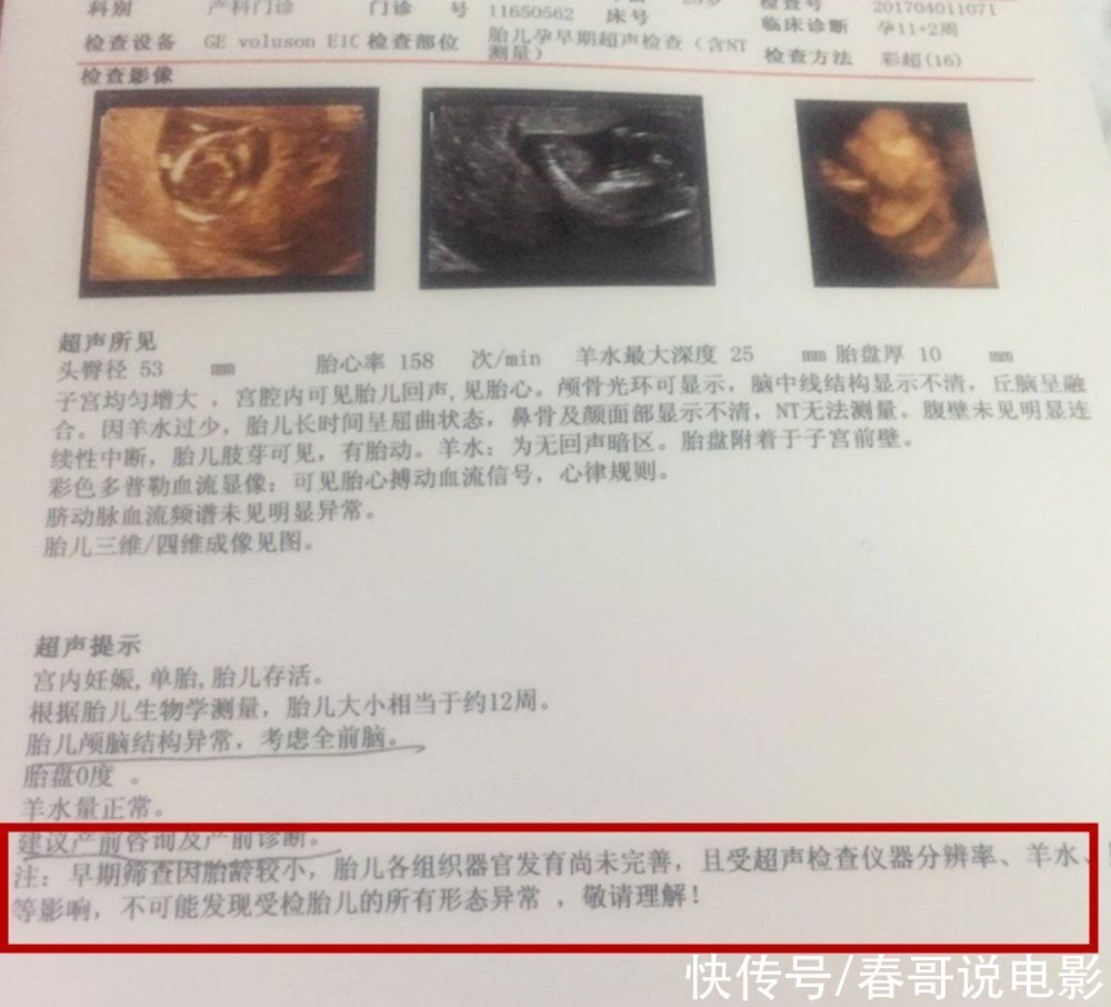 美国妇产科协会|胎儿发育得好不好，看看孕妈有无几种反应，全中的妈妈可要偷笑了