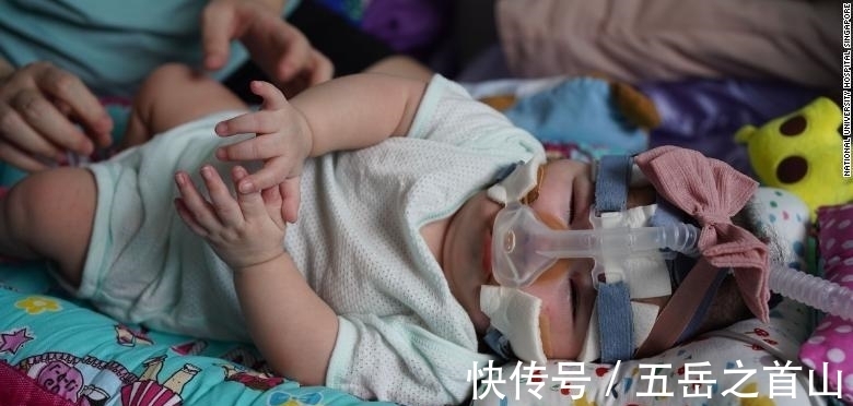 奇迹|生命的奇迹?出生仅212克的“世界最小婴儿”顺利出院